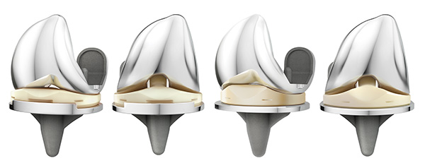 ATTUNE® Knee