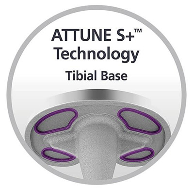 ATTUNE® Knee