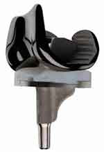 JOURNEY Implant Components
