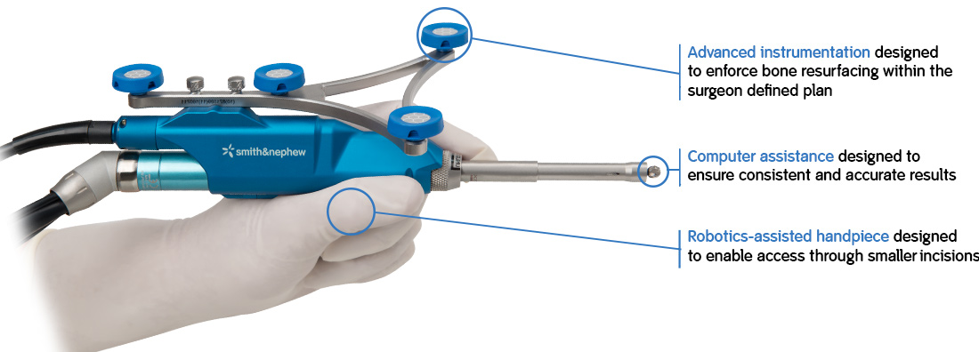 Navio Surgical System